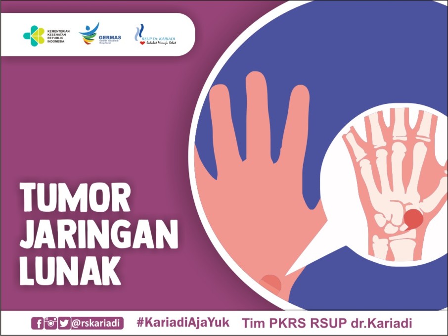 gambar tumor jaringan lunak
